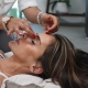 Acupuncture for face lift